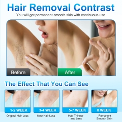 G992 IPL Hair Removal With Ice Application Super Energy Strong Hair Removal Effect